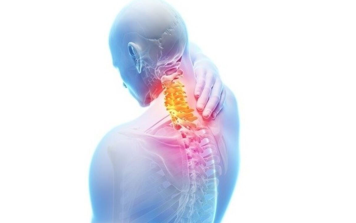 Neck pain with osteochondrosis