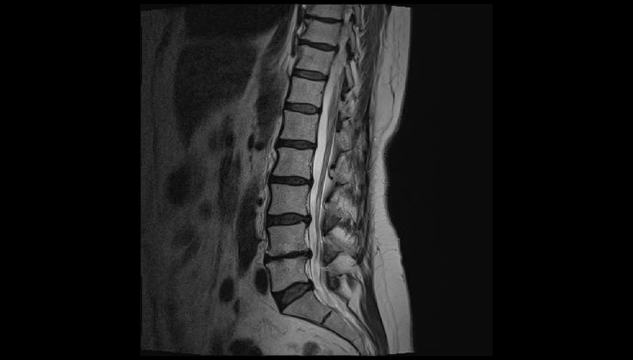 Diagnosing back pain in the lumbar region